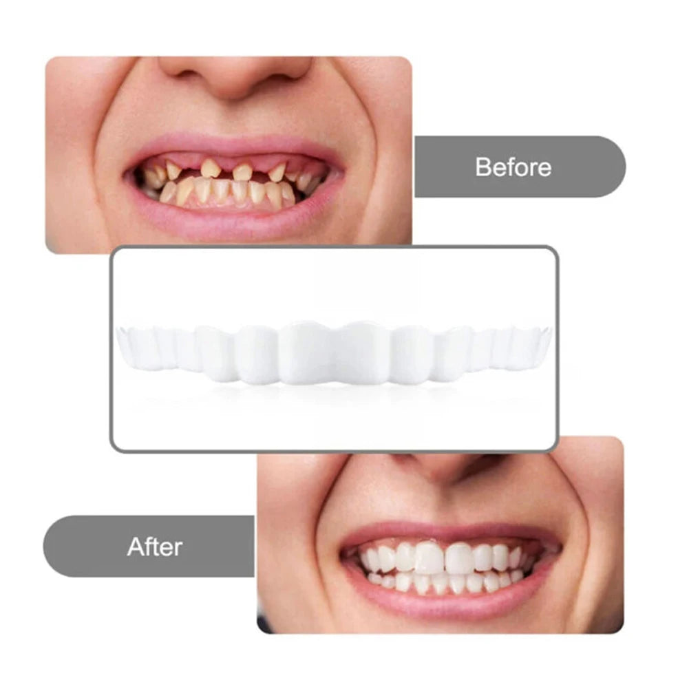 Temporary Teeth Veneers Whitening Denture Kit For A Confident Smile